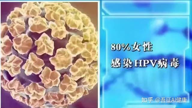 眼周长栗丘疹的两大原因