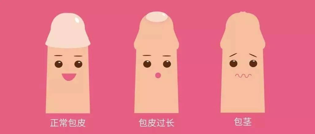 如何判断自己是否包皮过长