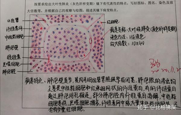 病理学实验红蓝铅笔图