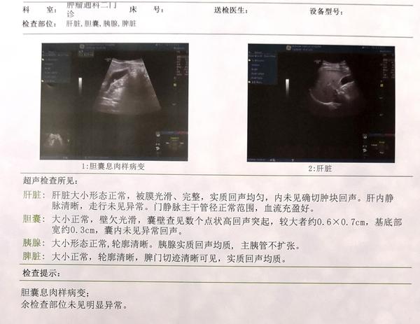 去年9月和今年5月两次彩超胆囊息肉位置不一样了,这次