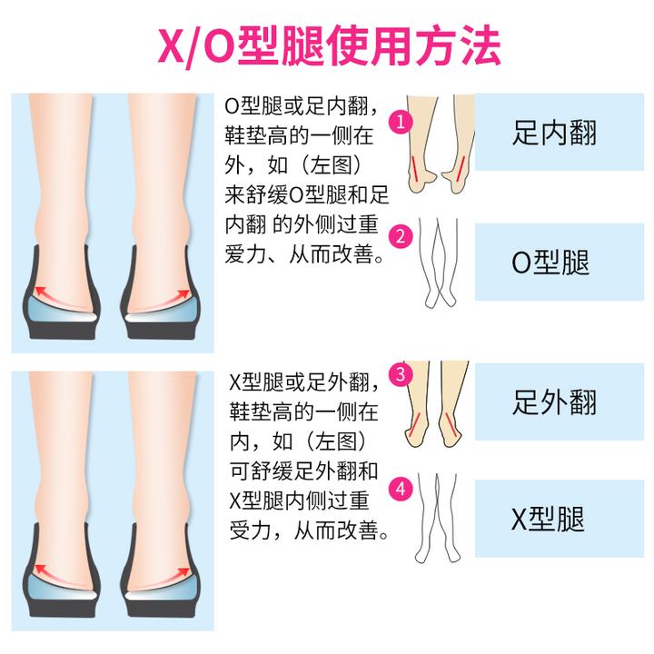 宝宝0型腿和,x型腿怎么办?