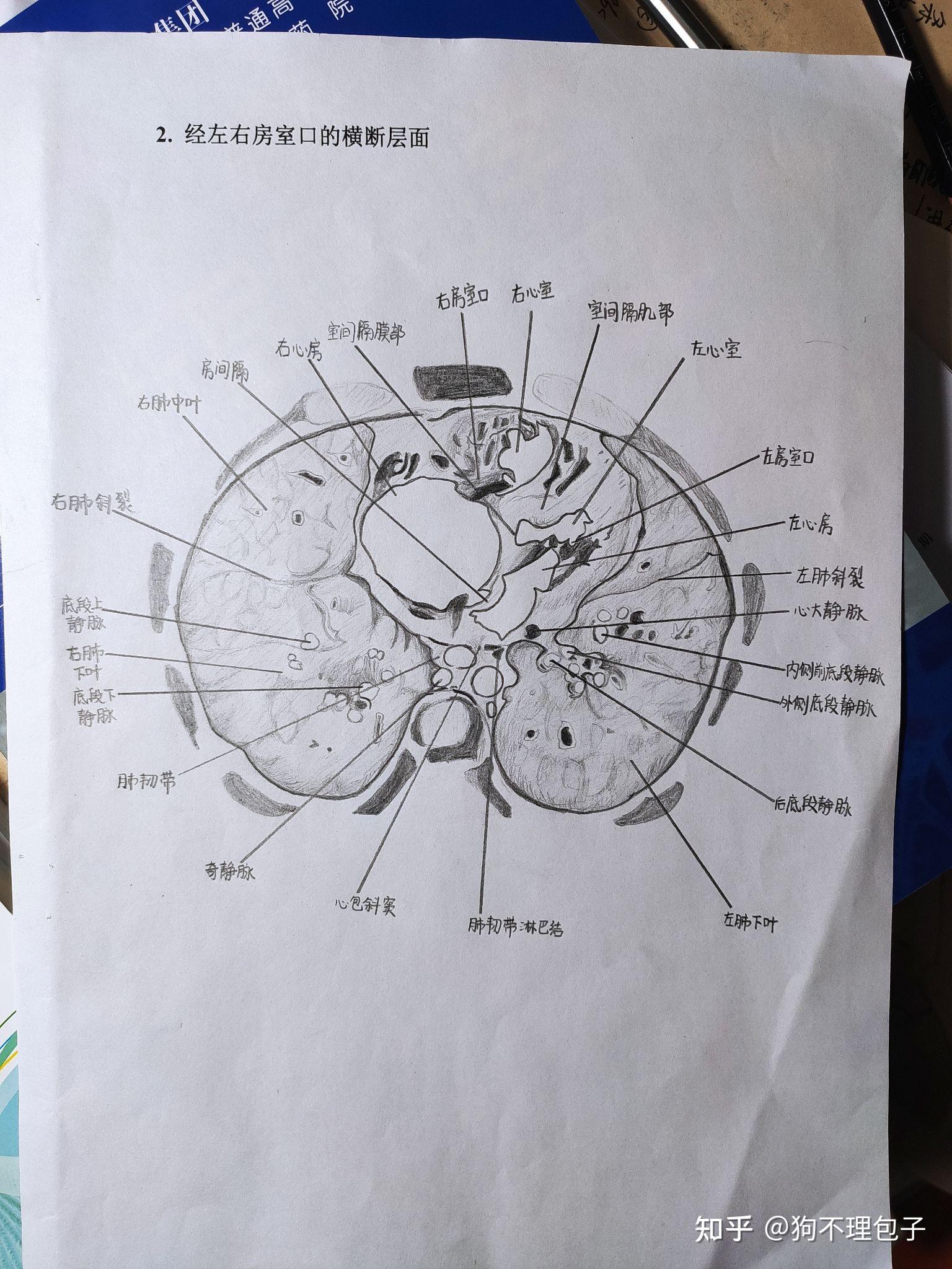 这张是乱入的哈下面就是我的断层解剖手绘图啦,虽然有的图画的些许