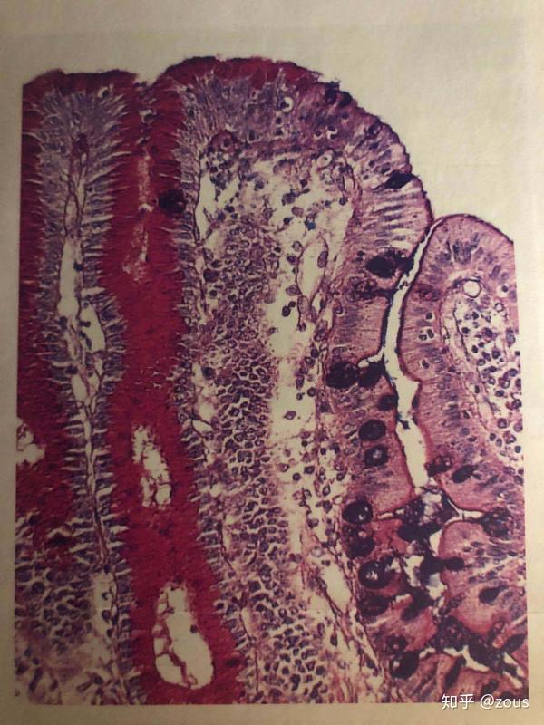 浆膜——包绕小肠外表面大部分,为纤维 间皮细胞.
