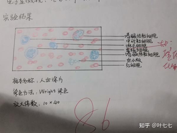 最严厉的一个老师改的 3,多级神经元脊髓切片