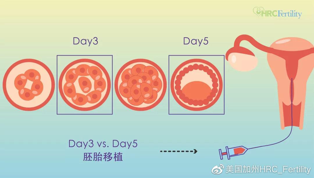 hrc课堂做试管婴儿应该选择第3天胚胎还是囊胚进行移植