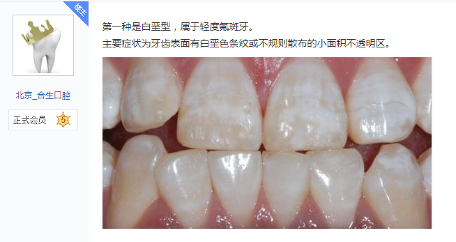 牙齿上有黄斑