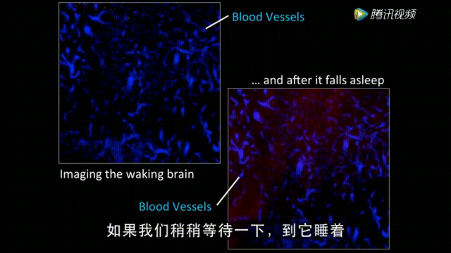 这意味着只有在睡眠状态下,脑脊液才会进行清理工作.