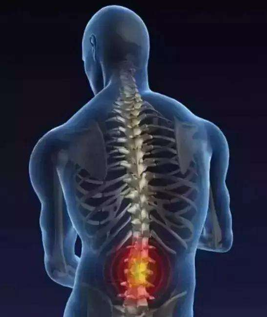 腰间盘突出症怎么办?如何治疗? 田惠林教授来帮您