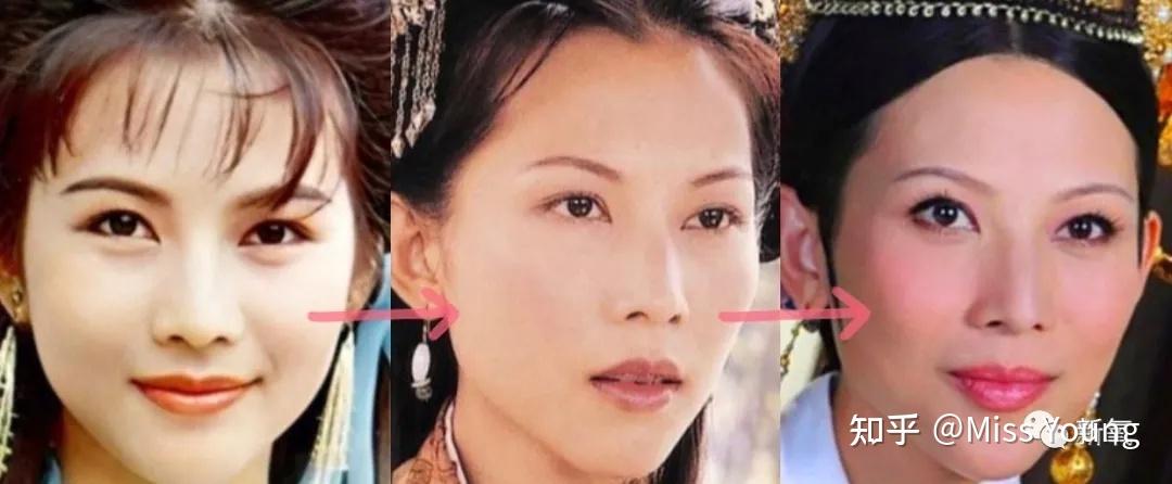 为什么蔡少芬颜值和年轻时候相差很大?
