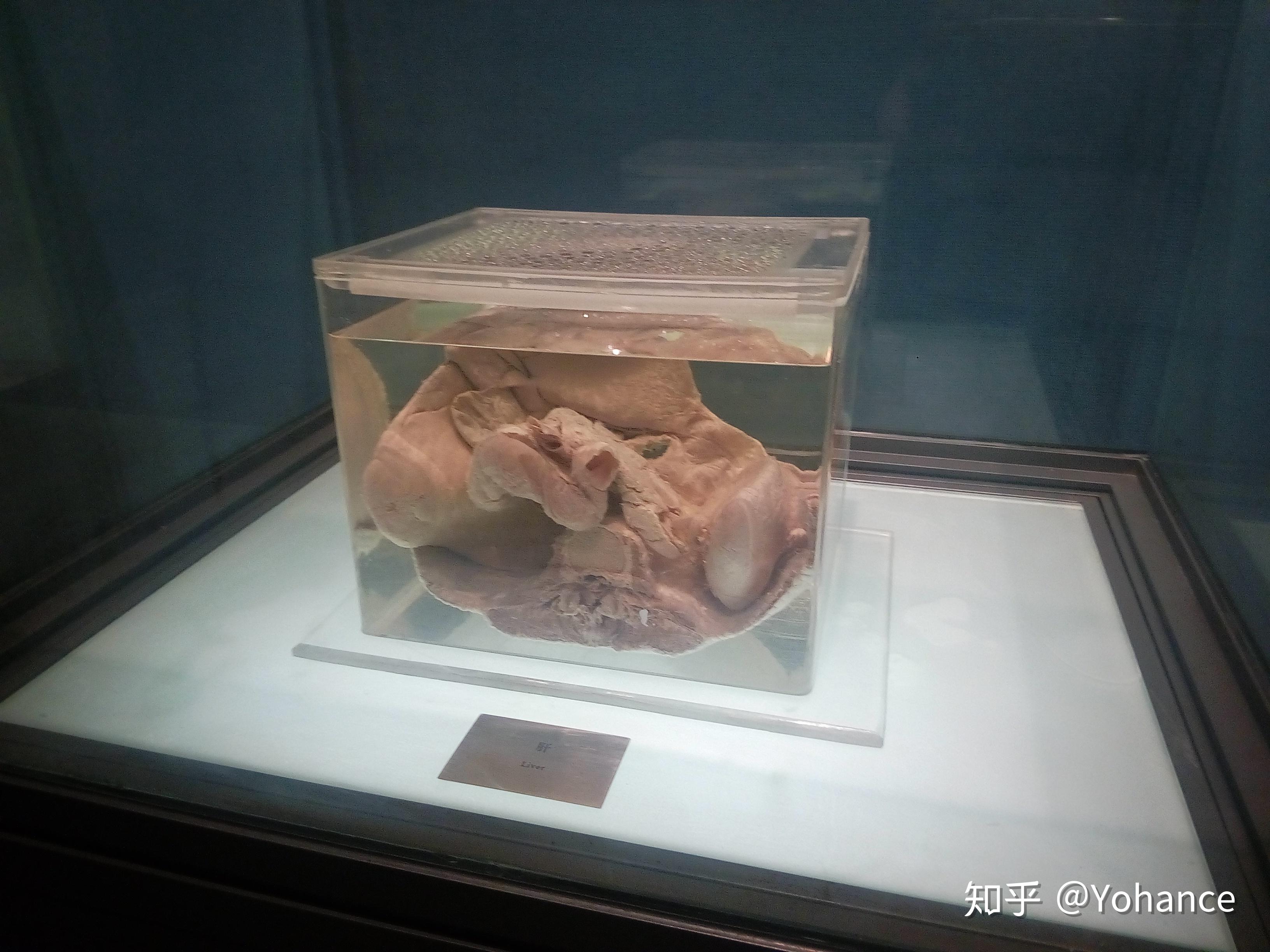 杭州自然博物馆里的人体标本是真的吗