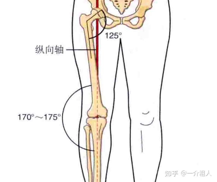 腿型是这样的:这种情况中,小腿偏上部有更大的弯曲