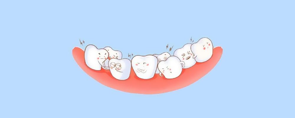 孩子牙齿畸形要等到12岁以后才矫正?儿童矫正了解一下