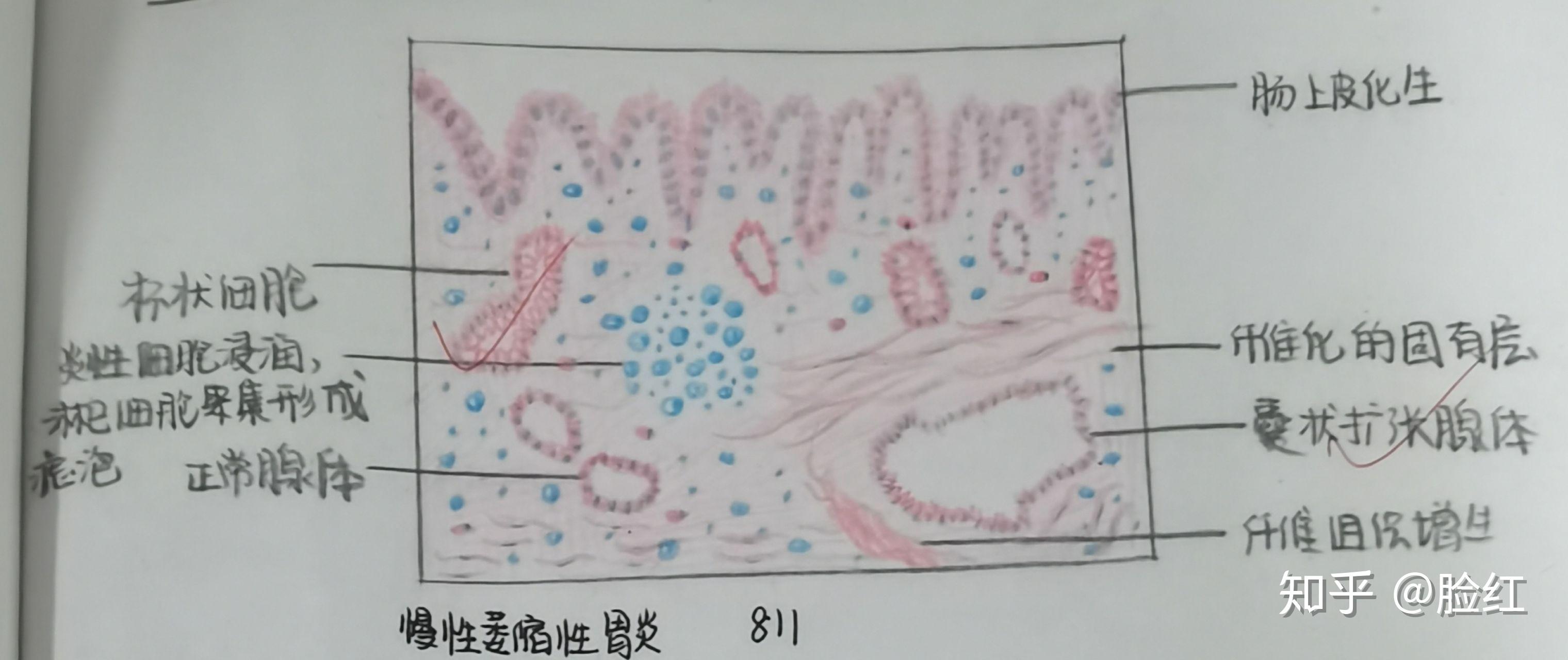 消化系统疾病硅肺小叶性肺炎大叶性肺炎6.