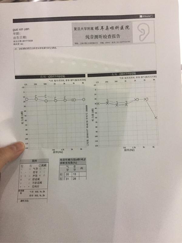 神经性耳聋是一种怎样的体验?