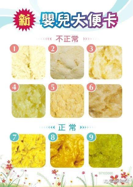 早产宝宝两天没拉粑粑 新生两天没大便怎么办