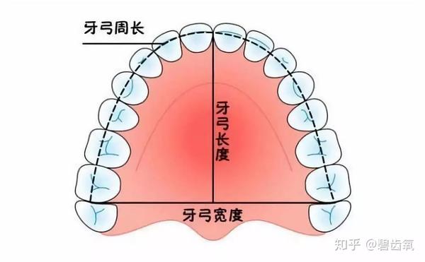 有的牙弓偏尖,有的牙弓偏方,这些都不是标准牙弓,甚至会影响牙齿排列