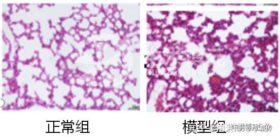 肺纤维化动物模型介绍 附小鼠博来霉素肺纤维化模型的详细步骤 知乎