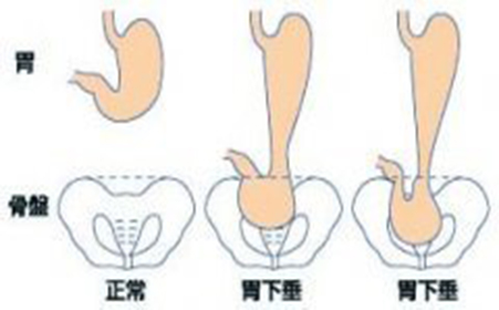 饭后做这些运动,既影响胃部消化又容易造成胃损伤