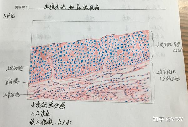 病理学 红蓝铅笔绘图