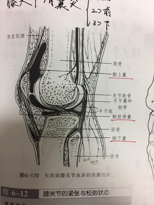 患者的mri显示,膝关节囊/髌上囊/髌下囊存在着积液,acl存在异常