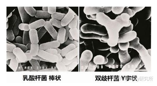 白带清洁度不佳怎么办如何提高白带清洁度