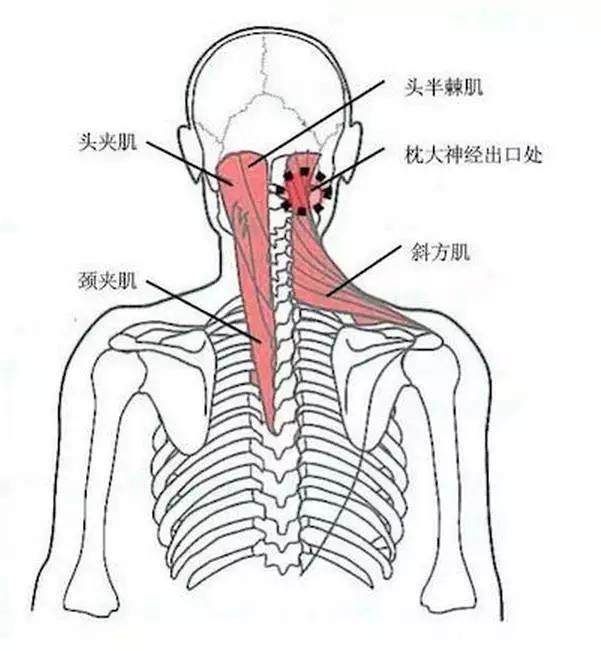 颈肩病常见的几个压痛点