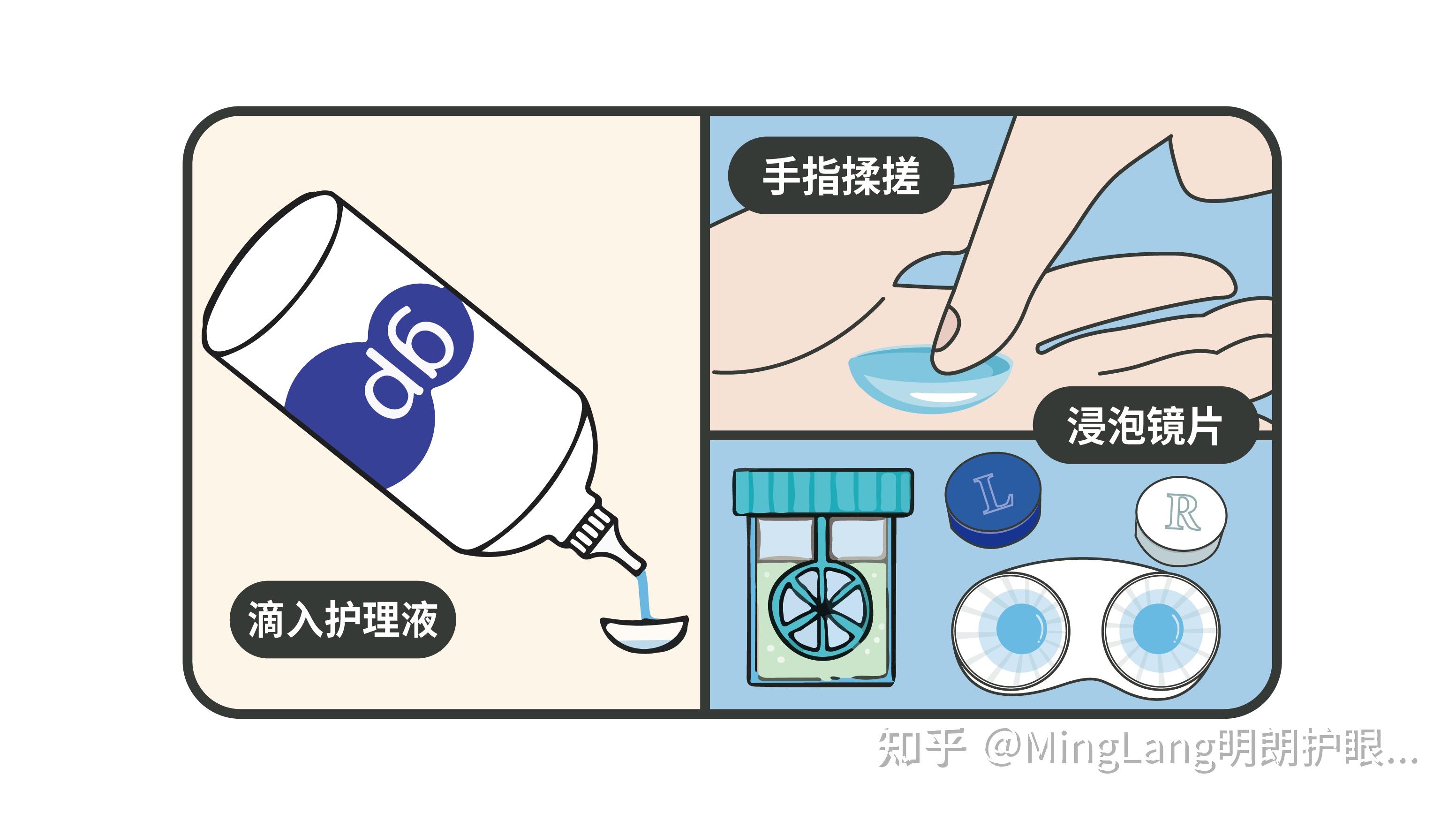 首先将护理液滴入镜片内,用指腹轻轻揉搓清洗镜片,并在优卓双氧水中