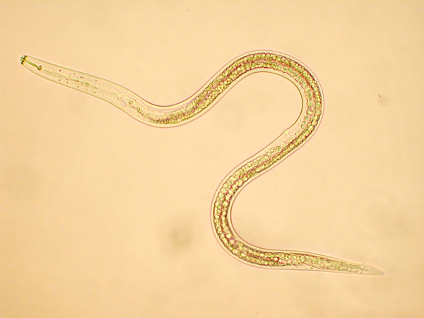 被某种生物寄生之后,他们患上了一种诡异的怪病