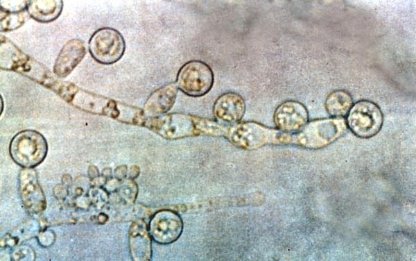 白色念珠菌 (图片来源:维基百科)
