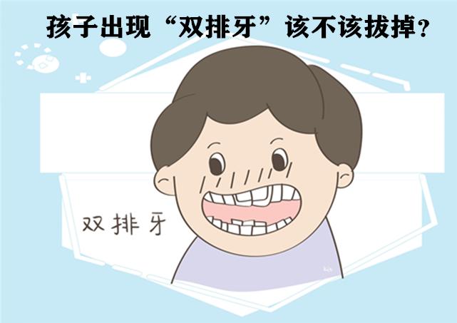 孩子出现"双排牙"该不该拔掉?