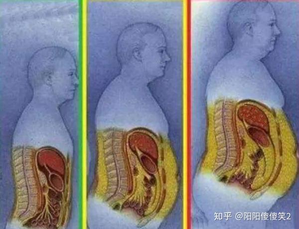 腹部脂肪堆积过程示意图