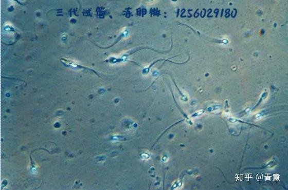 试管受精前能在显微镜下提前选择x或y精子吗