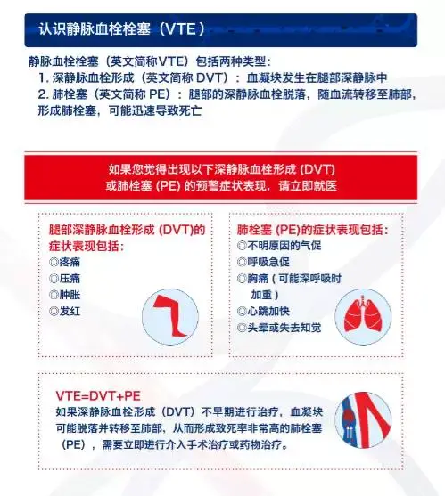 哪些人容易得静脉血栓栓塞?