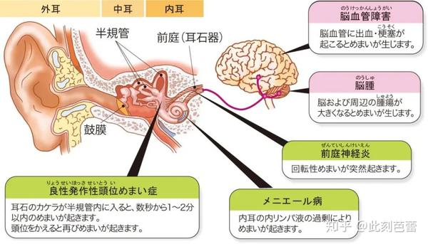 2-小脑中负责处理来自内耳前庭器官的感觉输入的区域