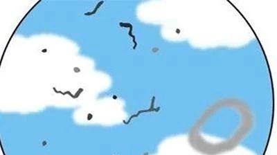 你有飞蚊症吗?近视者另外的一个隐友! mp.weixin.qq.com