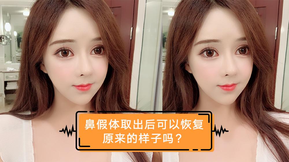 鼻假体取出后可以恢复原来的样子吗?