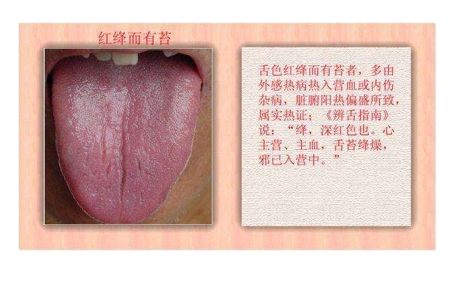 中医看诊为何要看舌苔?