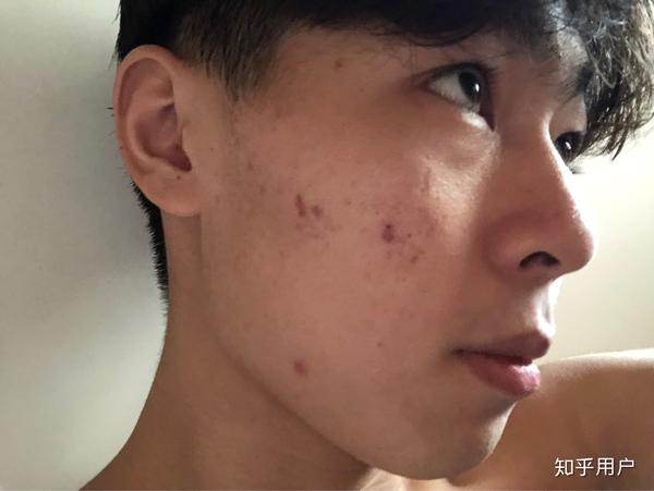 五官好看,皮肤差是什么体验?