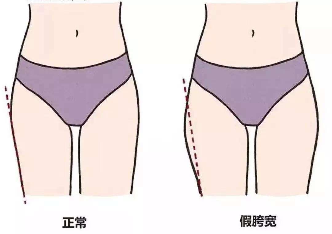产后骨盆修复有多重要?抓住产后恢复的黄金期