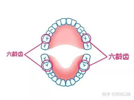 六龄齿 六龄齿不可替换.