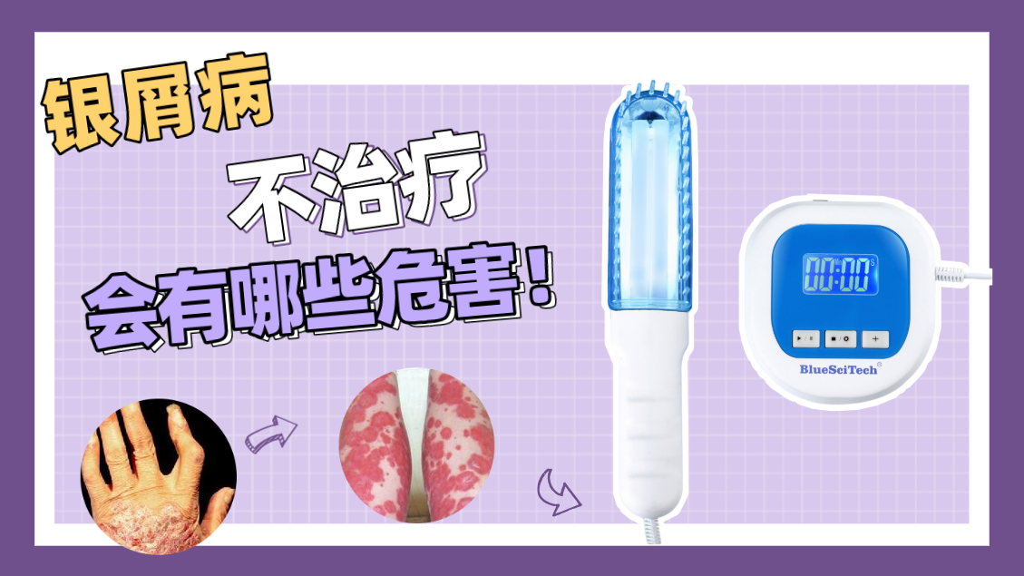 银屑病不治疗会有哪些危害