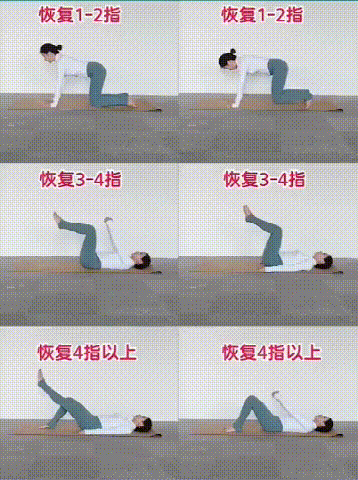 腹直肌分离