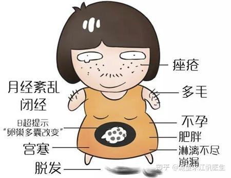 备孕难?罪魁祸首可能是多囊卵巢综合征