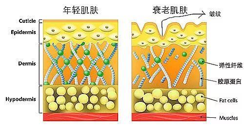 "自由基"和"ages"联手攻击胶原蛋白,后果就是:皱纹,粗糙,暗黄,松弛