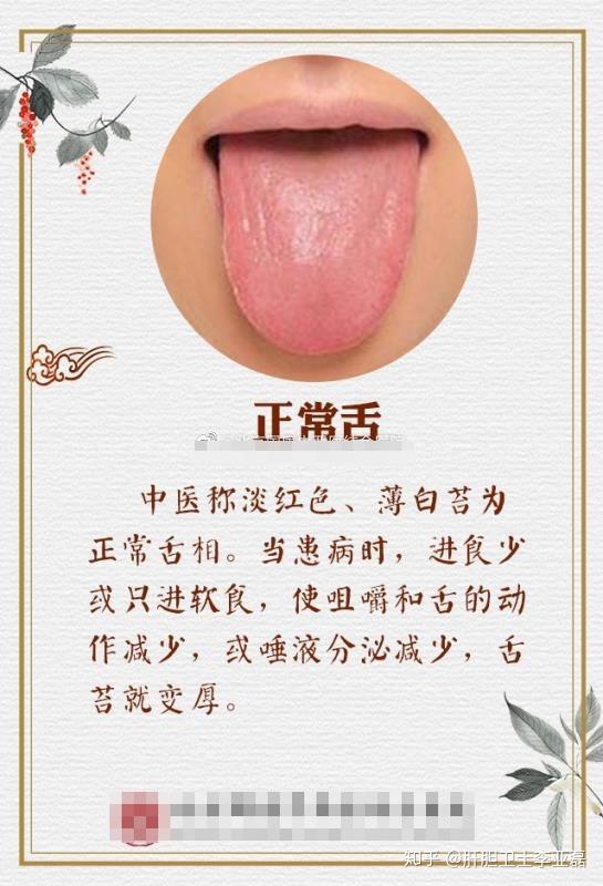 你的舌头还好吗快来测一测你属于哪种舌苔