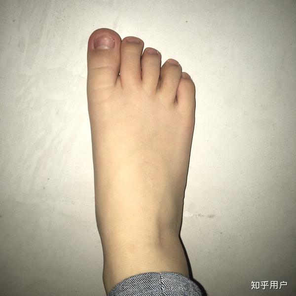 女生脚丑是种什么样的体验?