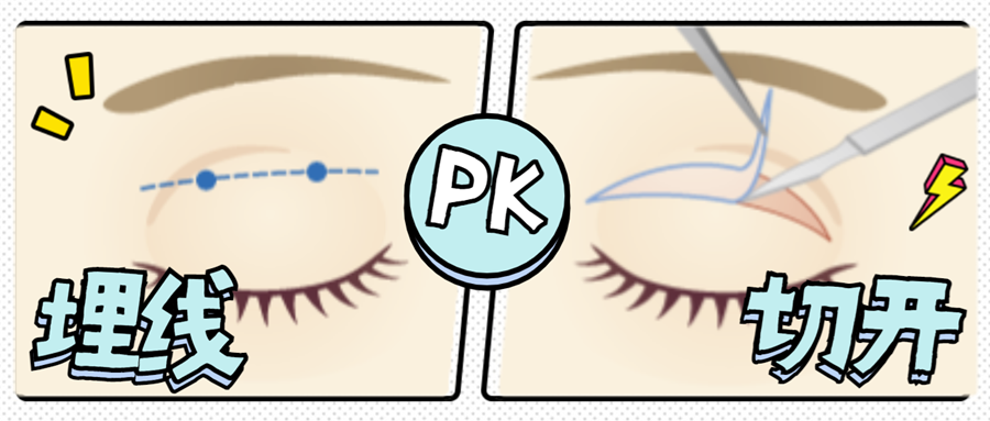 埋线双眼皮跟切开双眼皮如何选择