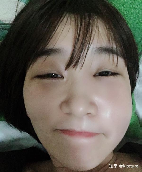 牙痛导致脸肿不做根管治疗可以自然好吗?