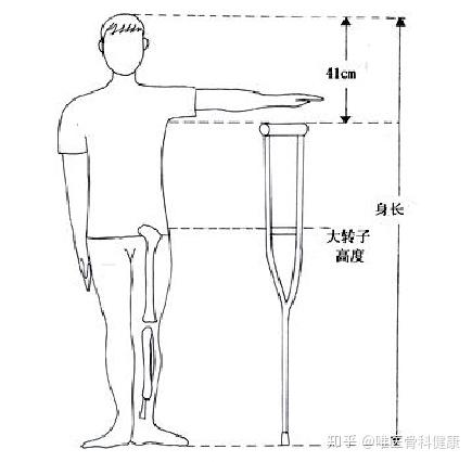 拐顶位置高度:身高-41cm; 还有一种方式是: 身体直立位时,手臂自然