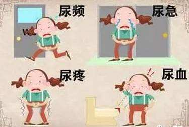 因支原体尿路感染进了icu!已经发生在我们身边别不重视!